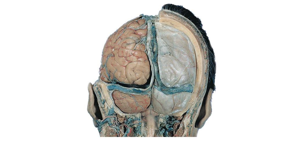 Occipital lobe Tentorium cerebelli Cerebellum Arachnoid mater over medulla oblongata (b)