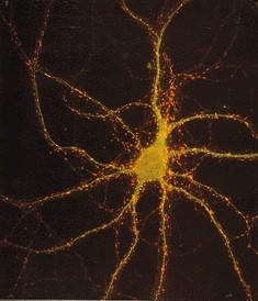 Nervous tissue Neurons unipolar neuron pseudounipolar neuron