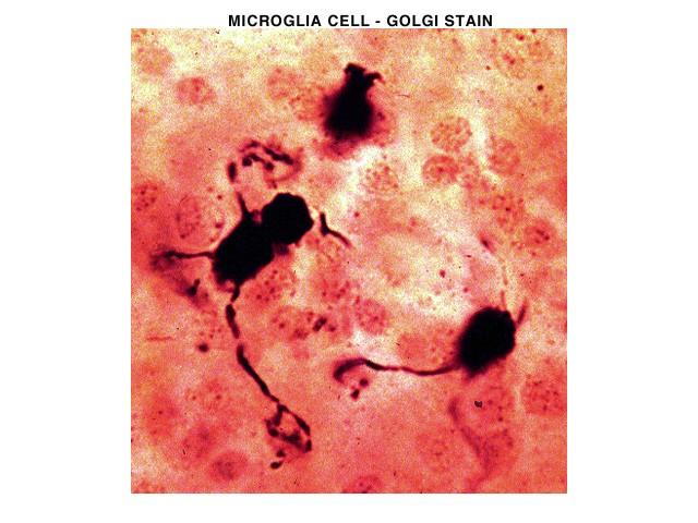 CNS Neuroglia 2. Microglia 3.