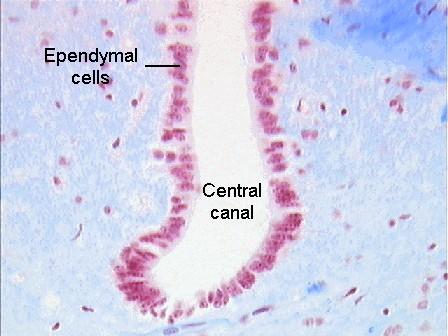 Cells Low columnar epithelial-esque cells that line the ventricles of the