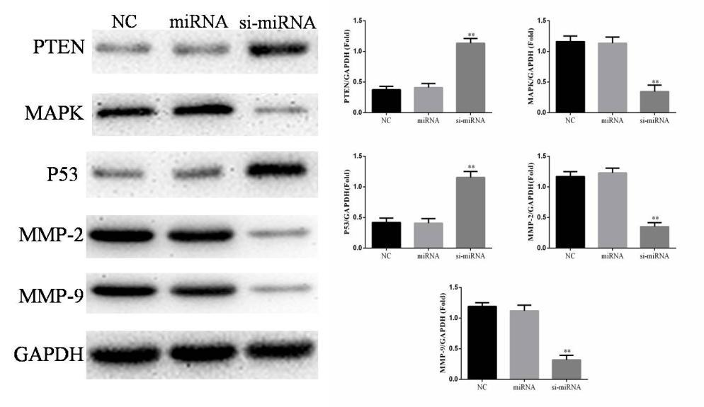 The PTEN and p53 protein expression were significantly up-regulation and MAPK, MMP-2 and MMP-9