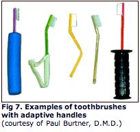 CSHCN Patient Factors Oral hygiene-challenges Adapt toothbrush Chewing/swallowing