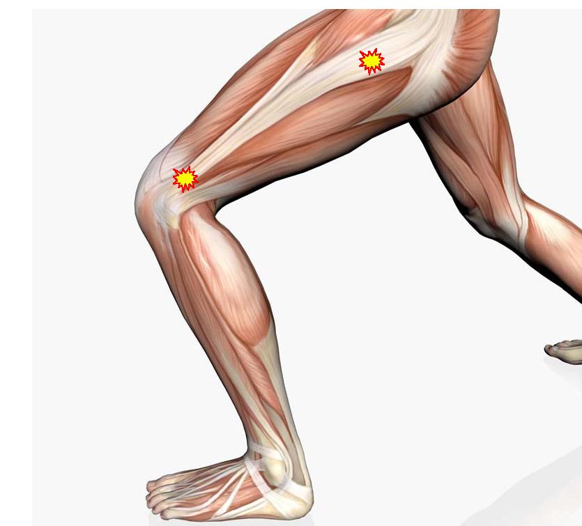 Injury of the week - Illio-tibial band friction syndrome The ITB is a non elastic cord originating from just below the pelvis, to below the outside of the knee.