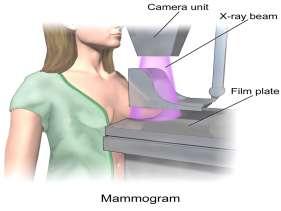 is specialized medical imaging that uses a low-dose x-ray system to see inside the breasts.