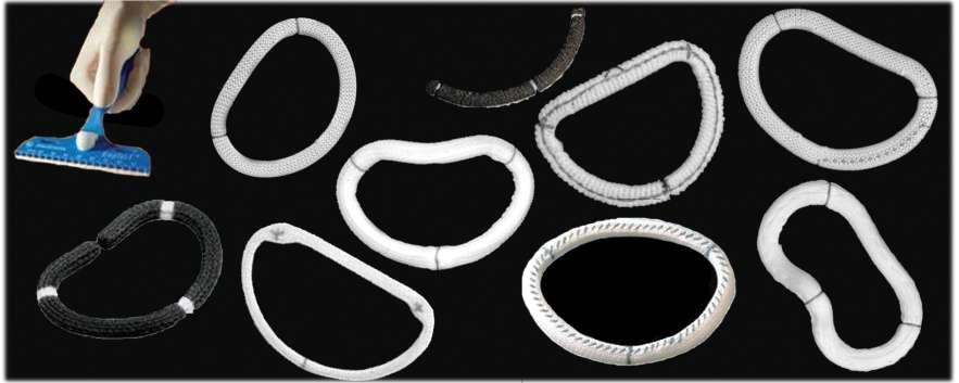Large variety of annuloplasty rings available a.) Various shapes (flat, saddle, dog bone) b.