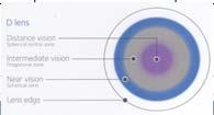 Practitioners Primary Method of Myopia Control Pharmaceutical agents 11% 21% Don't utilize myopia control 37% A combination of pharmaceutical agents and contact lenses 5% Peripheral Optical Profile