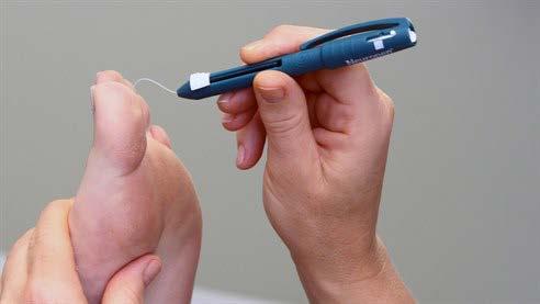 Diabetes mellitus continues to grow in global