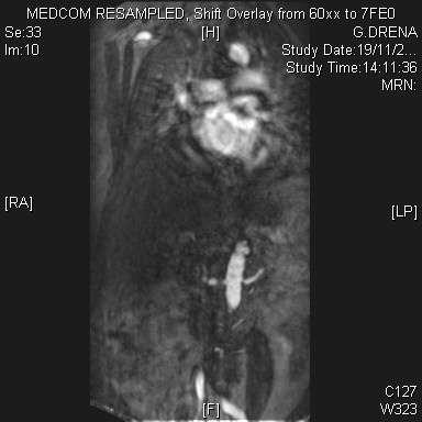 CT Angio / MRI: Size