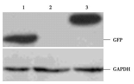 Figure 5. Detection of GFP protein expression in TT cells with Western blot. Lane 1: TT-GFP cells; lane 2: TT cells; lane 3: TT-S100A13-GFP cells. Figure 6.