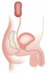 Urine is carried from the kidneys through tubes called ureters to the bladder, where it is temporarily stored until urination occurs.