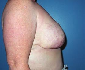 4 - This patient is shown before and