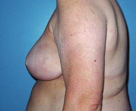 5 - This patient is shown before and