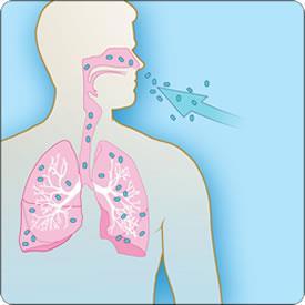 Routes of Transmission Inhalation Most infected patients develop prominent respiratory symptoms