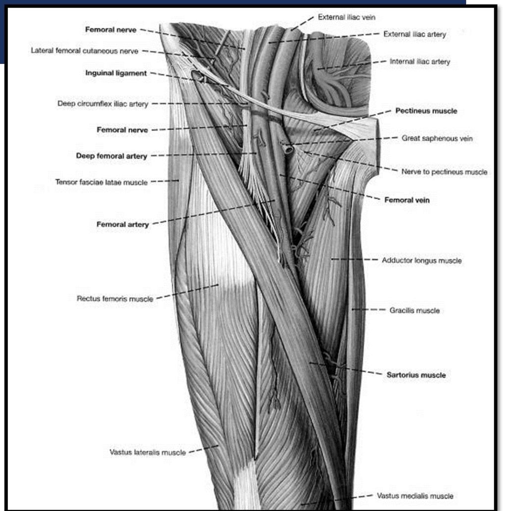 FEMORAL APPROACH Positioning Supine Needle placement Medial to femoral artery Needle held at 45
