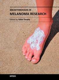 Breakthroughs in Melanoma Research Edited by Dr Yohei Tanaka ISBN 978-953-307-291-3 Hard cover, 628 pages Publisher InTech Published online 30, June, 2011 Published in print edition June, 2011