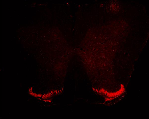 Figure 5. Detection of GAP-43 expression by immunofluorescence. Immunofluorescence revealed the GAP-43 expression in the spinal cord of CCI rats.