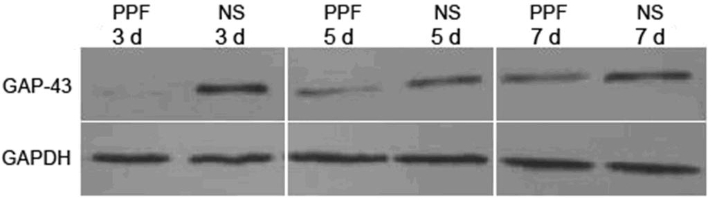 Figure 6. Detection of GAP-43 expression by western blot assay.