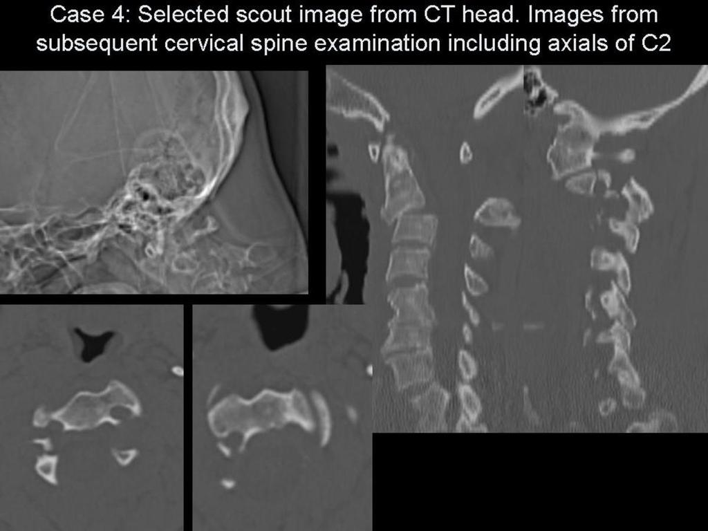 Fig.: Firgure 14. Selected images for case 4.