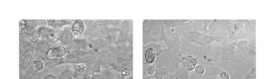 F KLS cells were sorted as a PI Lin CD11b CD11c ckit Sca1 Flt3 subset, and F KLS cells were sorted as a PI Lin CD11b CD11c ckit Sca1 Flt3 subset.