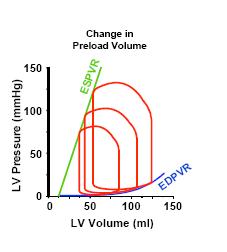 Remodeling 0 0 50 100 150 200 250 LV Volume (ml) Cardiac Chamber