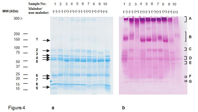 30 S. Takehara et al. J Med Dent Sci a b Figure 4 : Analyses of salivary proteins and glycoproteins (representative samples) by SDS-PAGE. The same sample numbers indicate identical saliva samples.