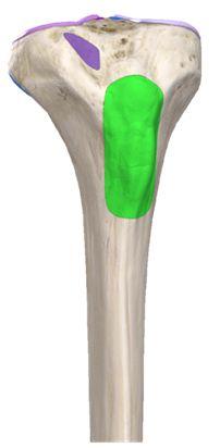 Lateral condyle : is smaller and articulates with lateral condyle of femur.