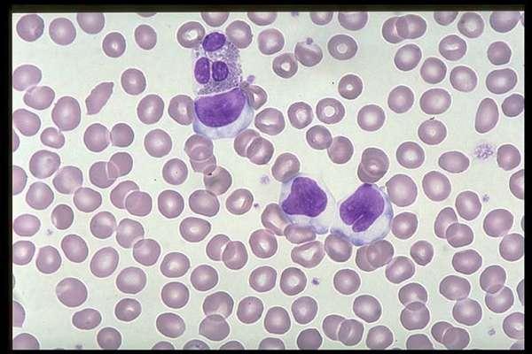 Erythrocytes with diameters greater than 9µm are called macrocytes.