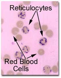 Reticulocytes Younger erythrocytes recently released by the bone marrow into the bloodstream often contain residual ribosomal RNA, which, in the