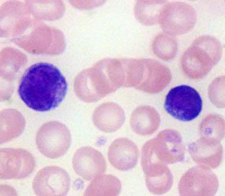Lymphocytes They can be classified into several groups according to distinctive surface molecules (markers).