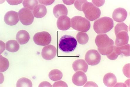 Lymphocytes The small lymphocyte, which is predominant in the blood, has a spherical nucleus, sometimes with an indentation.