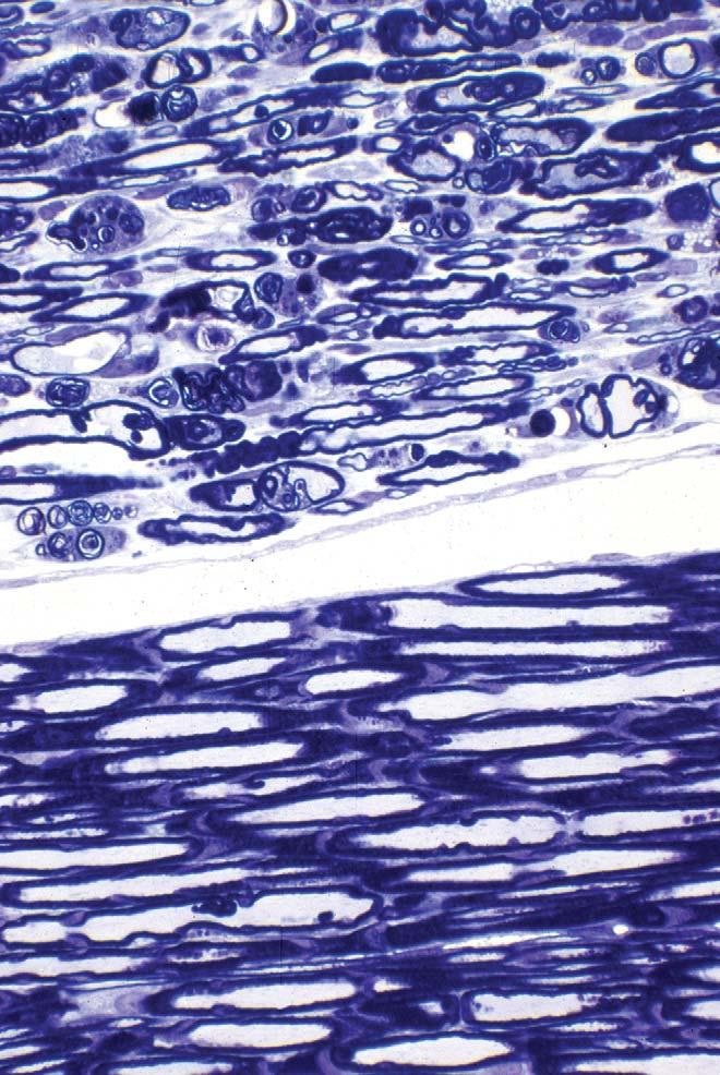 mitochondria. In B, neuronal necrosis has occurred, and the neuron is being phagocytized by satellite cells. Toluidine blue and safranin stain. FIGURE 8.