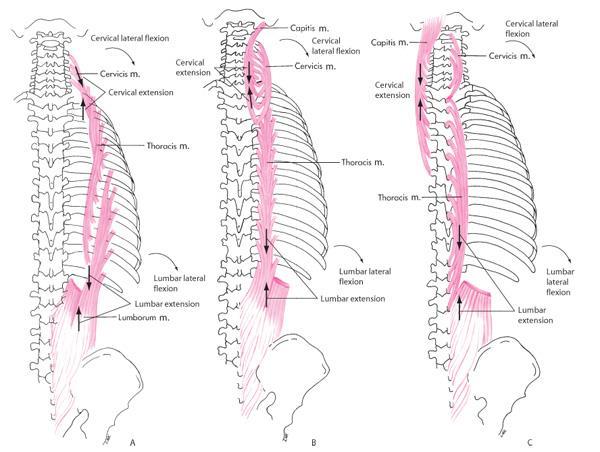 Erector Spinae Muscles (sacrospinalis) Iliocostalis (lateral layer) Longissimus (middle layer) Spinalis (medial layer)
