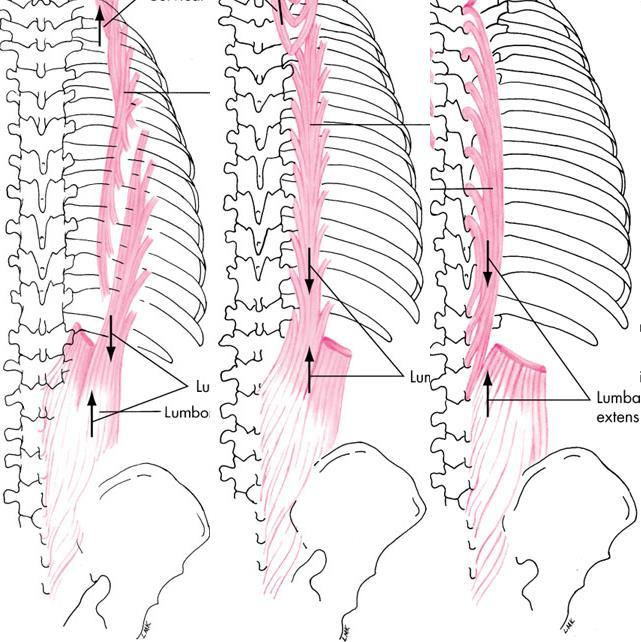 Erector spinae External oblique abdominal