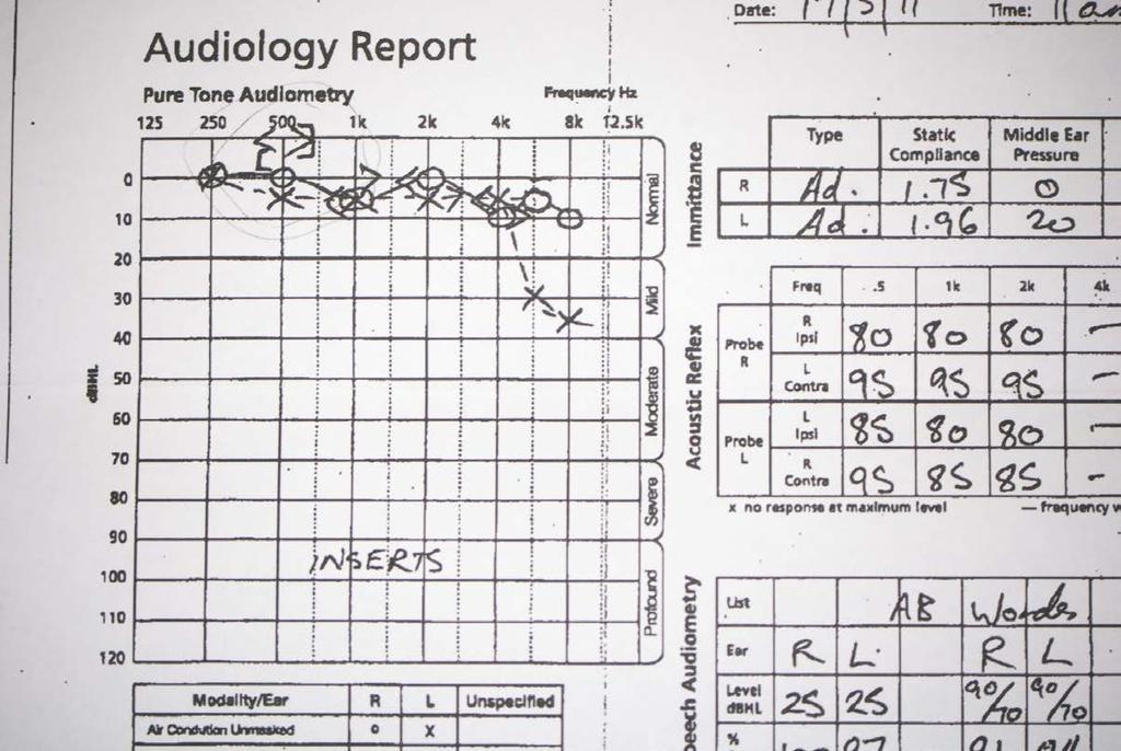 Audiology of the previous frame case, showing
