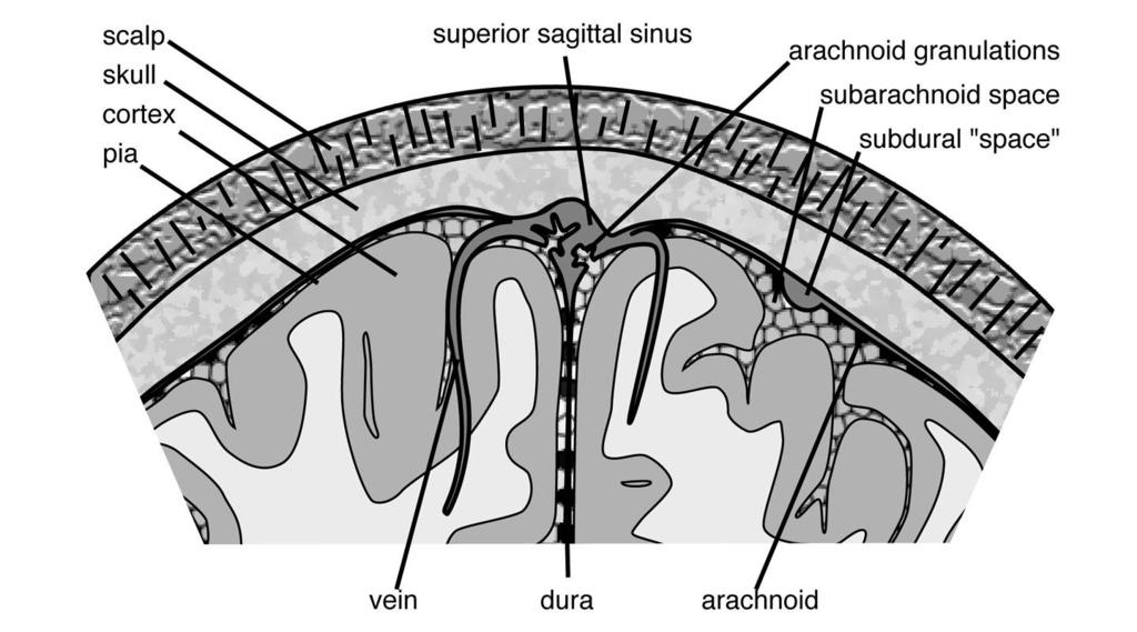 Meningitis, compartments (pachymeninges) (leptomeninges) Skull Dura Outer arachnoid ~ CSF