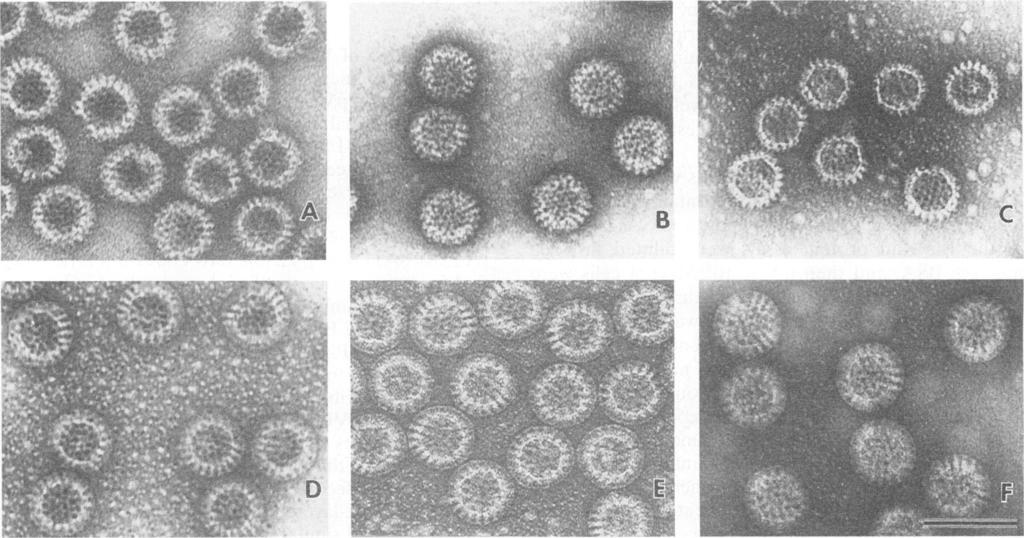 5948 CRAWFORD ET AL. J. VIROL. WN.',- FIG. 1. Electron micrographs of different formulations of VLPs produced by coexpression of baculovirus recombinants containing rotavirus genes.
