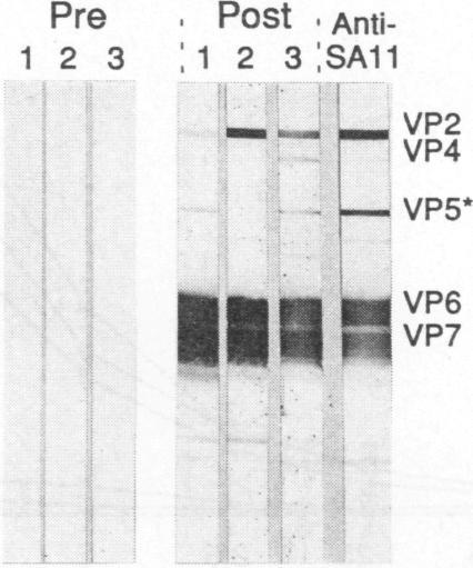 ...,.t,_ ~~VP5* VOL. 68, 1994 VLPs SAl 1 2 3 4 I..6 VP2.-._ VP4 ': VP6 H W VP7 FIG. 3. Comparison of native triple-layered SAi1 and VP2/4/6/7 particles by Western blot analysis.