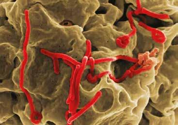 October 16, 2014 What You Need to Know about Ebola The 2014 Ebola epidemic is the largest in history This outbreak is affecting multiple countries in West Africa.