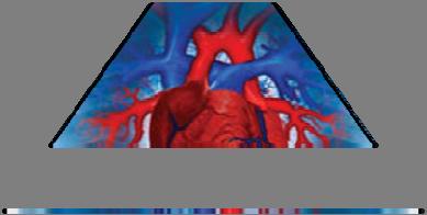 fibrillation Bioprosthetic valve Mechanical valve in the aortic position Deep-vein thrombosis