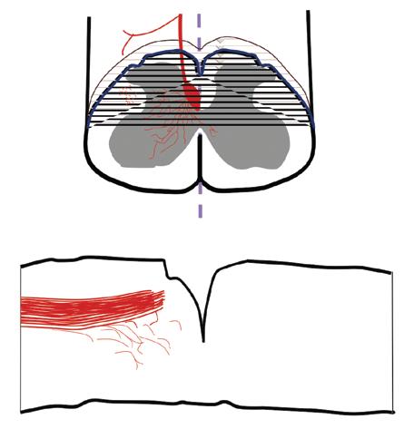 The pperne of leled fiers in sggitl setion is shown in the low pnel.