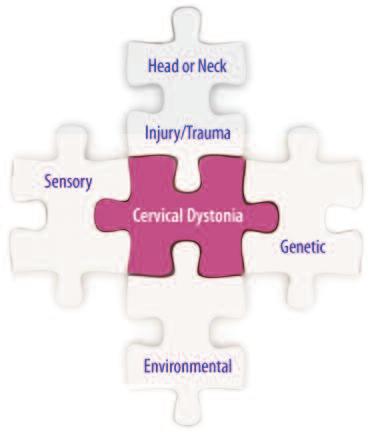 What causes cervical dystonia? The exact cause of cervical dystonia is still unclear.