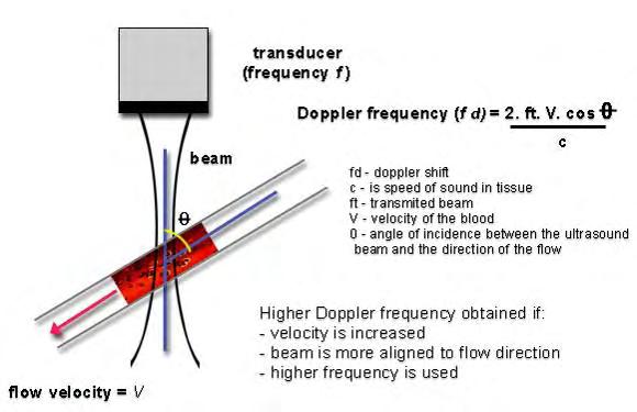 Figure 2: Doppler ultrasound. Doppler ultrasound measures the movement of the scatterers through the beam as a phase change in the received signal.