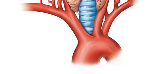 artery Isthmus of thyroid gland Trachea Brachiocephalic artery Left subclavian artery Left