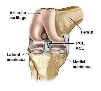 ANTERIOR CRUCIATE LIGAMENT INJURIES A torn anterior cruciate ligament (ACL) is one of the most common knee ligament injuries. Approximately 1 in 3000 Americans will injure their ACL.