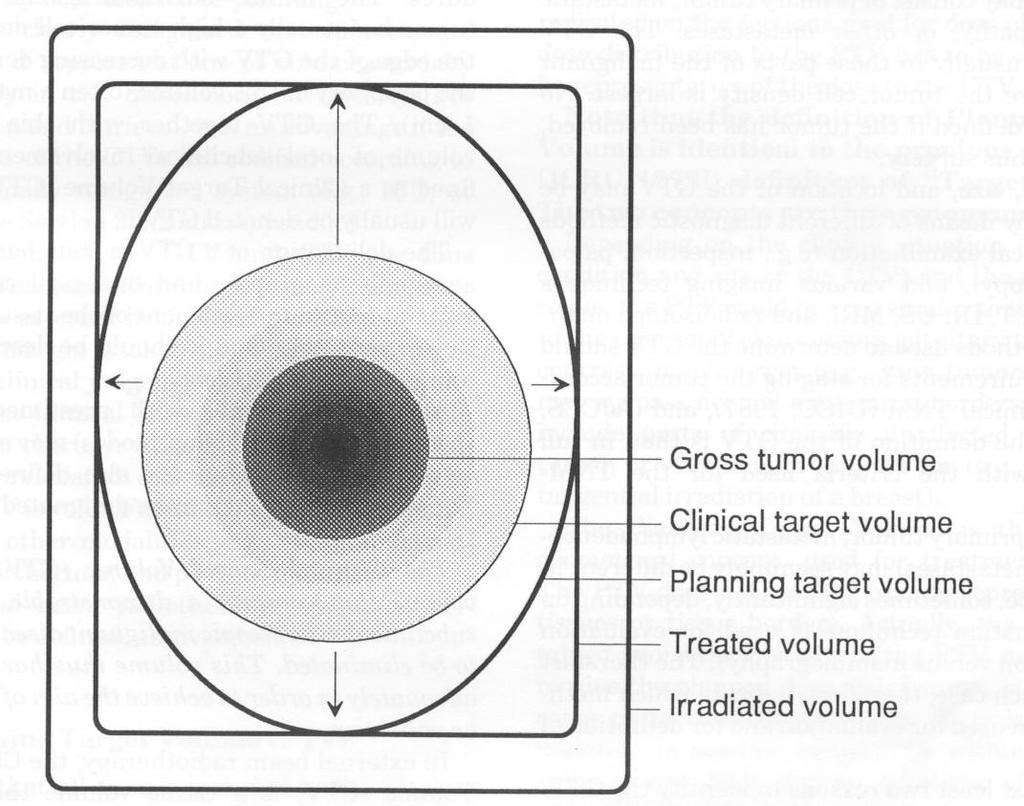 Target delineation ICRU 50 & 62 Gross Tumor Volume (GTV) = clinically demonstrated