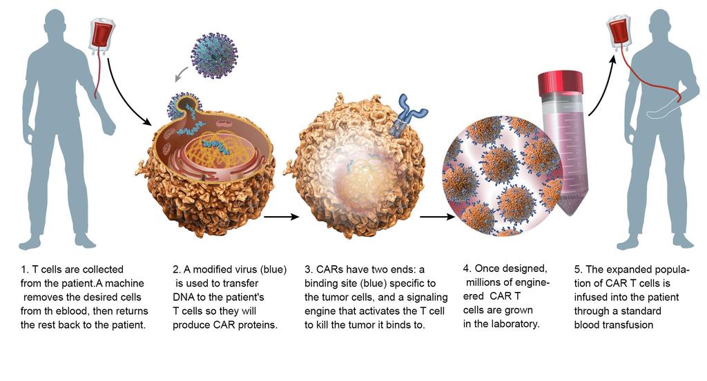 T cells CAR-T are white blood cell cells therapy that attack and 11 kill viruses and cancer cells I hope Chimeric antigen receptors (CARs) help T-cells recognize
