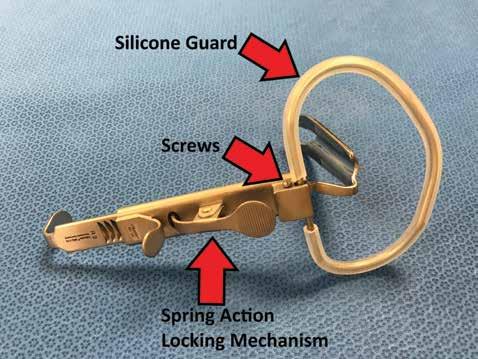 Some needle holding forceps have tungsten carbide jaw inserts (indicated by gold ring handles) that can be removed when they become worn from use or damaged.