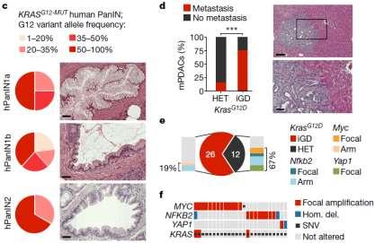 Role of KRAS in Pancreatic Cancer > Increase in gene dosage of mutant KRAS in hpdac precursors, which