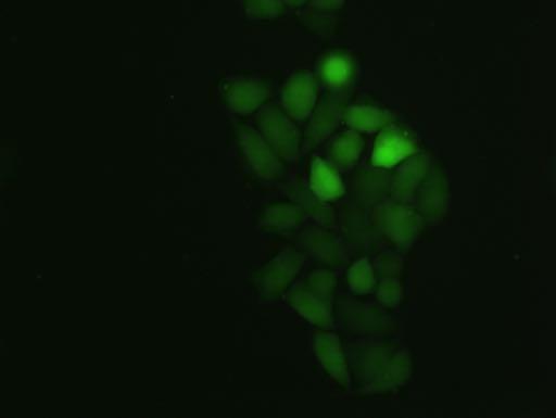 (b), (c) Fluorescence microscopy images of ela cells treated with 10-µM peptide 3 (b) and R9 (c) for 30 min at 4 o C. The peptides fluoresced in the cells (green).