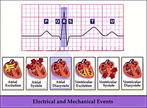 Background-ECGs and QRST ECGs are regularly used by doctors to diagnose patients with heart problems Normal ECG waveform: P depolarization as signal moves through atria QRS
